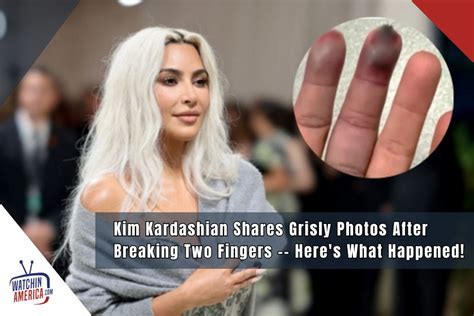 kim.kardashian fingers|what happened to kims fingers.